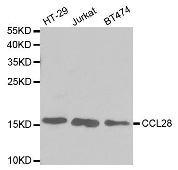 Western blot - CCL28 antibody (144-02596)