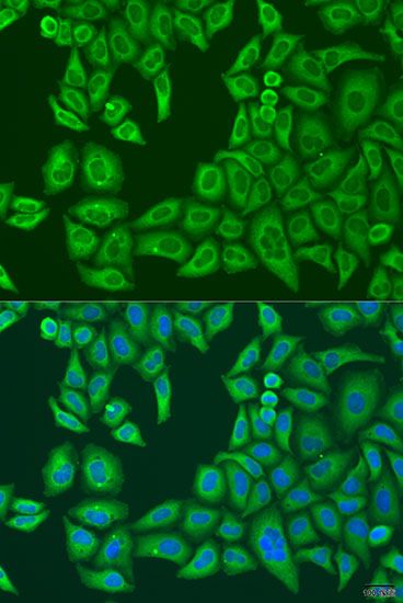 Immunofluorescence - ABCF2 antibody (144-04365)