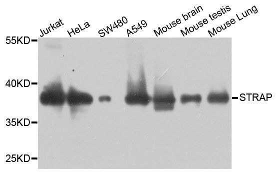 Western blot - STRAP antibody (144-05964)