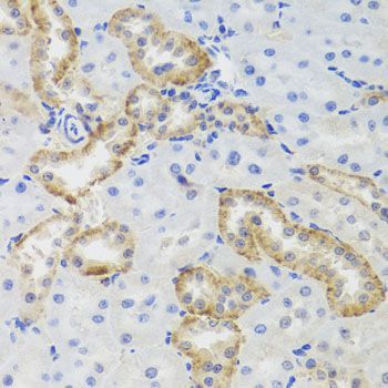 Immunohistochemistry - MTERFD3 antibody (144-08518)