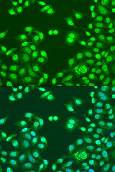 Immunofluorescence - NUMA1 Polyclonal Antibody (144-00527)