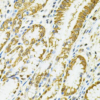 Immunohistochemistry - HLA-DQA1 antibody (144-02168)