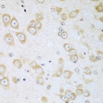 Immunohistochemistry - ACOX1 antibody (144-08091)