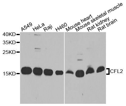 Western blot - CFL2 antibody (144-08009)