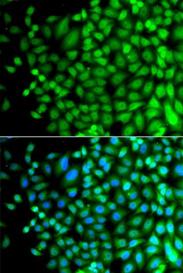 Immunofluorescence - SUPT20H Polyclonal Antibody (144-07374)
