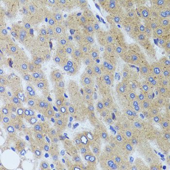 Immunohistochemistry - SYNPO antibody (144-08484)