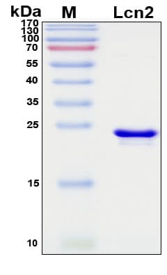 SDS-PAGE Image