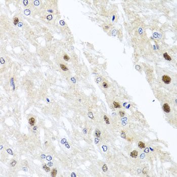 Immunohistochemistry - YTHDF3 antibody (144-08395)