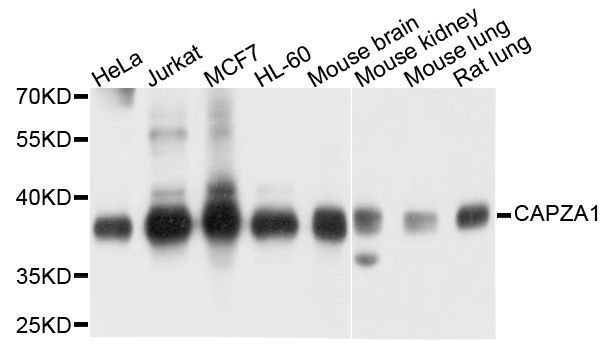 Western blot - CAPZA1 antibody (144-03776)