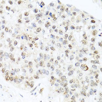 Immunohistochemistry - CETN3 antibody (144-08111)