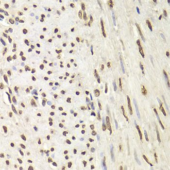 Immunohistochemistry - HNRNPD Polyclonal Antibody (144-01828)