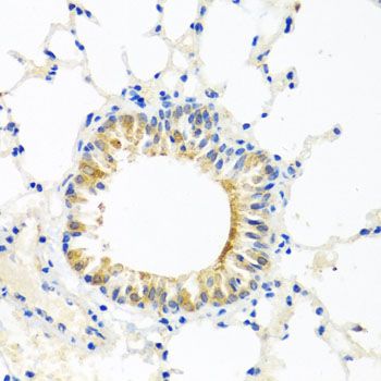 Immunohistochemistry - COQ7 antibody (144-07768)