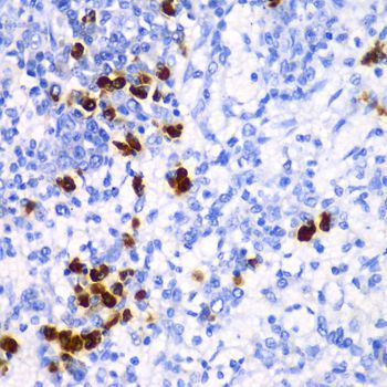 Immunohistochemistry - TFAM Polyclonal Antibody (144-013552)