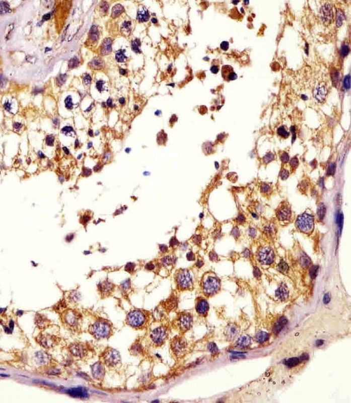 IHC-P