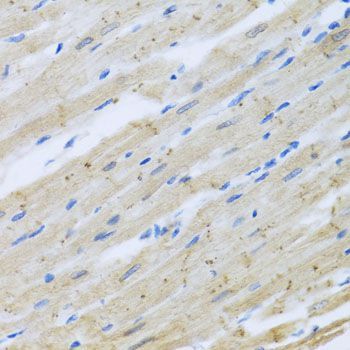 Immunohistochemistry - CLIP1 antibody (144-07722)