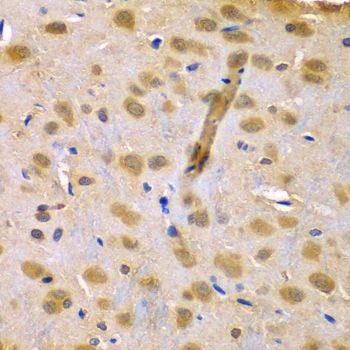 Immunohistochemistry - RUFY1 antibody (144-07836)