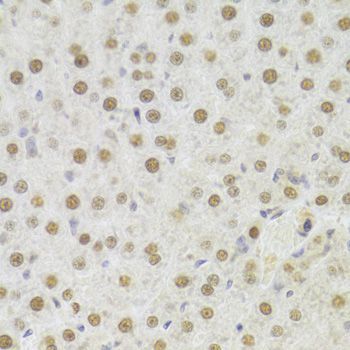 Immunohistochemistry - HDGF Antibody (144-05347)