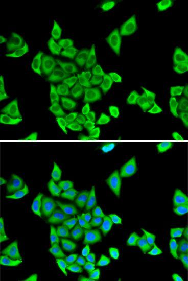 Immunofluorescence - CIAPIN1 Polyclonal Antibody (144-06336)
