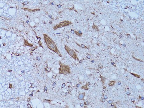 Immunohistochemistry - HADH Polyclonal Antibody (144-01076)