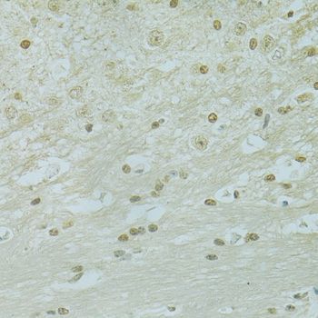 Immunohistochemistry - RCC1 Polyclonal Antibody (144-06350)