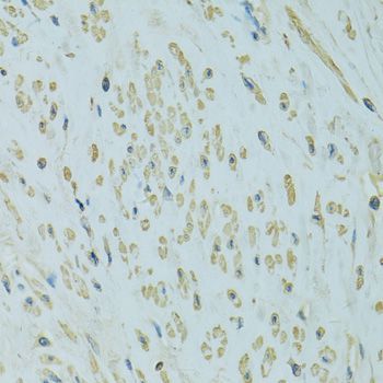 Western blot - UGT1A6 Polyclonal Antibody (144-10033)