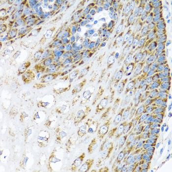 Immunohistochemistry - LRPPRC antibody (144-03365)
