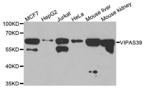Western blot - VIPAS39 antibody (144-03479)