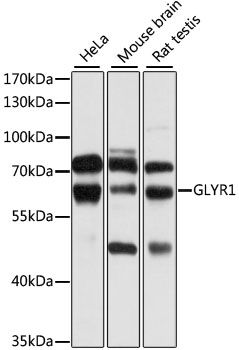 Western blot - GLYR1 antibody (144-09046)
