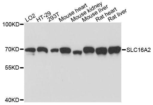 Western blot - SLC16A2 antibody (144-61367)