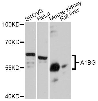Western blot - A1BG antibody (144-11583)