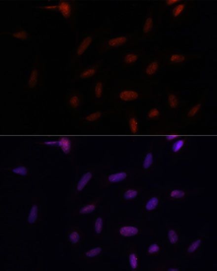 Immunofluorescence - PARP1 Polyclonal Antibody (144-60002)