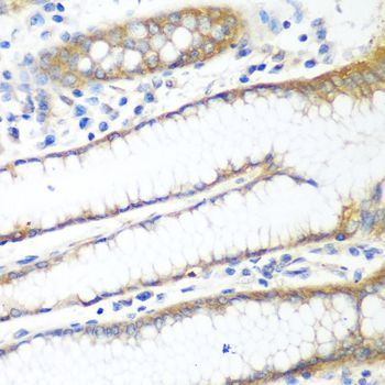 Immunohistochemistry - PPP4R1 Polyclonal Antibody (144-08361)