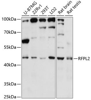 Western blot