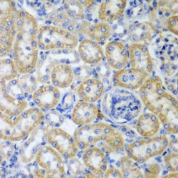 Immunohistochemistry - KITLG Polyclonal Antibody (144-05672)