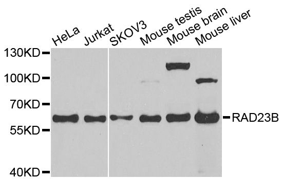 Western blot - RAD23B Polyclonal Antibody (144-01034)