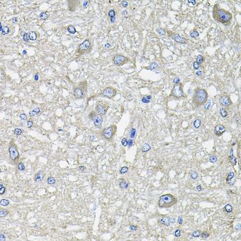 Immunohistochemistry - GFPT1 antibody (144-03882)
