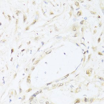 Immunohistochemistry - STAT1 Polyclonal Antibody (144-012075)