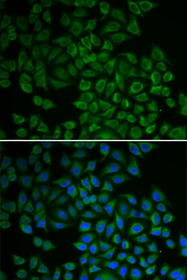Immunohistochemistry - SGK1 Polyclonal Antibody (144-01025)
