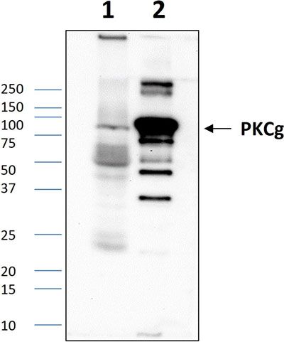 Western blot