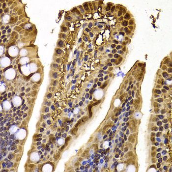 Immunohistochemistry - XPO5 Polyclonal Antibody (144-06790)