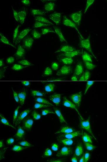 Immunofluorescence - ICOS antibody (144-01811)