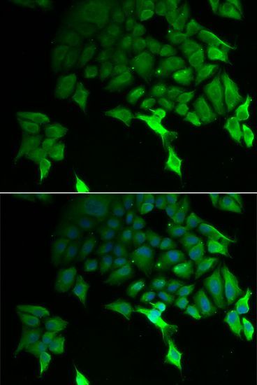 Immunofluorescence - TSC22D3 Polyclonal Antibody (144-06779)