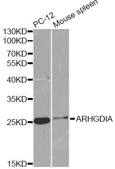 Western blot - ARHGDIA Polyclonal Antibody (144-603448)