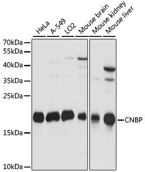 Western blot - CNBP antibody (144-60919)