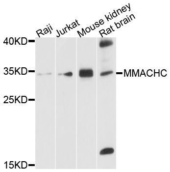 Western blot - MMACHC Polyclonal Antibody (144-600535)