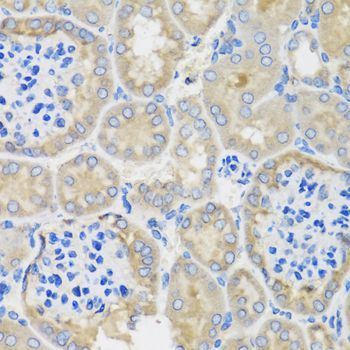 Immunohistochemistry - ACVR1C Polyclonal Antibody (144-00678)