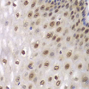 Immunohistochemistry - DDX5 antibody (144-60268)
