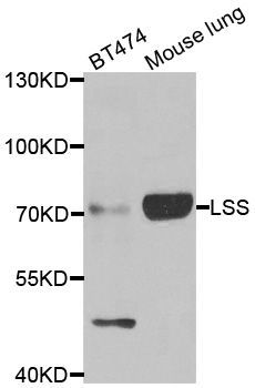 Western blot - LSS antibody (144-06930)