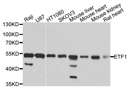 Western blot - ETF1 antibody (144-05920)