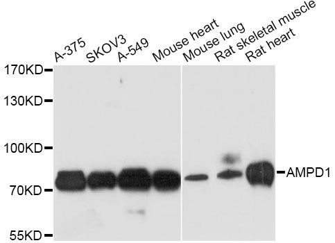 Western blot - AMPD1 antibody (144-03584)
